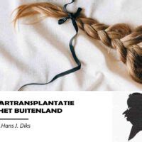 Haartransplantatie In Het Buitenland: Is Het De Moeder Waard?