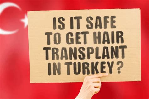Waarom Haartransplantatie Populair Is In De Moderne Wereld